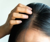 علاج تساقط الشعر: الدليل الكامل!