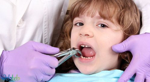 خلع الأسنان: نصائح لما "قبل وبعد" خلع السن