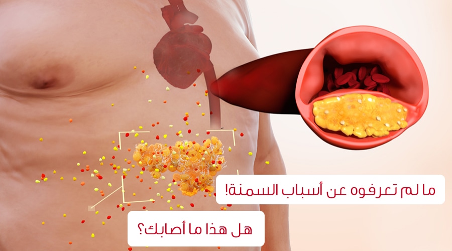 اسباب السمنة التي قد تفاجئكم!