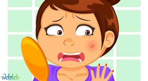 دواء حب الشباب: العلاج وما الذي يجب تجنبه؟