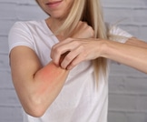علاج حساسية الجلد كيف يتم وما هي تداعياته؟