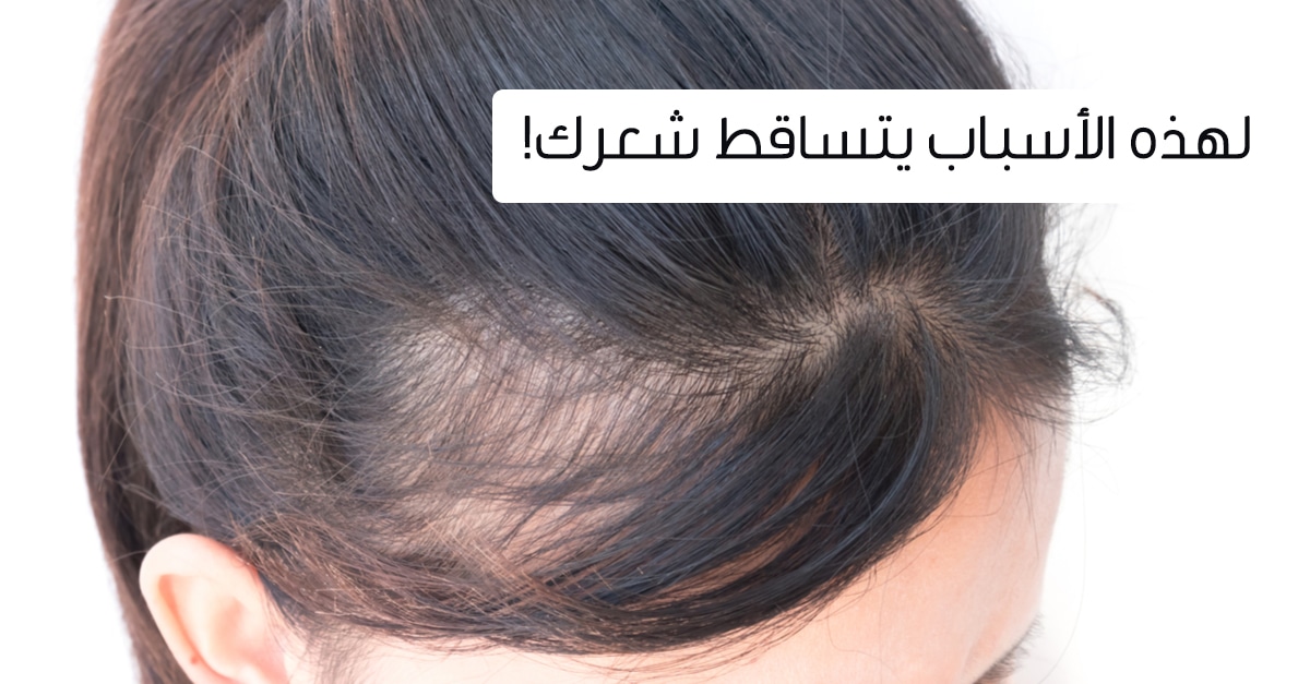 اسباب تساقط الشعر عند النساء ويب طب