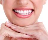 تلبيسة الأسنان الجزئية: أبرز المعلومات