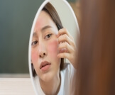 احمرار الوجه: تخلص منه بطرق بسيطة