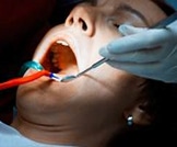 خراج الأسنان: أهم المعلومات