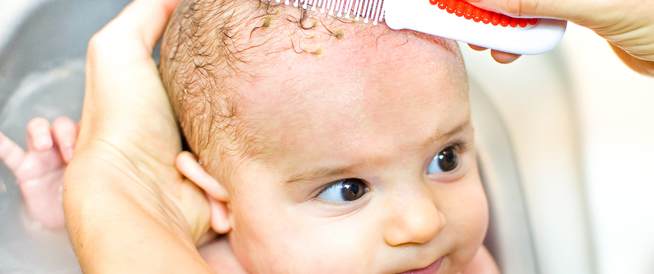 قبعة المهد عند الرضيع: ما تود معرفته