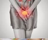 التهاب المسالك البولية لدى النساء