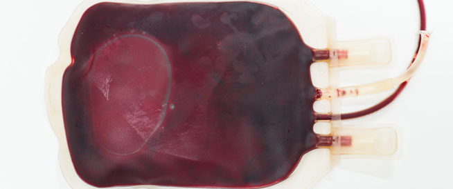 فرط حجم الدم في الجسم: هذا ما عليك معرفته