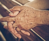 أمور تحدث للجلد مع تقدم العمر: تعرف عليها