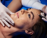 أضرار عمليات التجميل: تعرف عليها