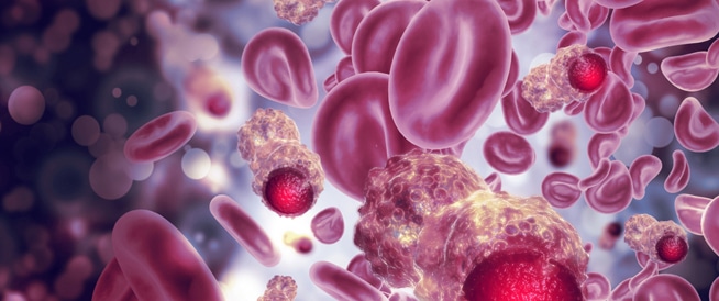 أنواع سرطان الدم: تعرف عليها