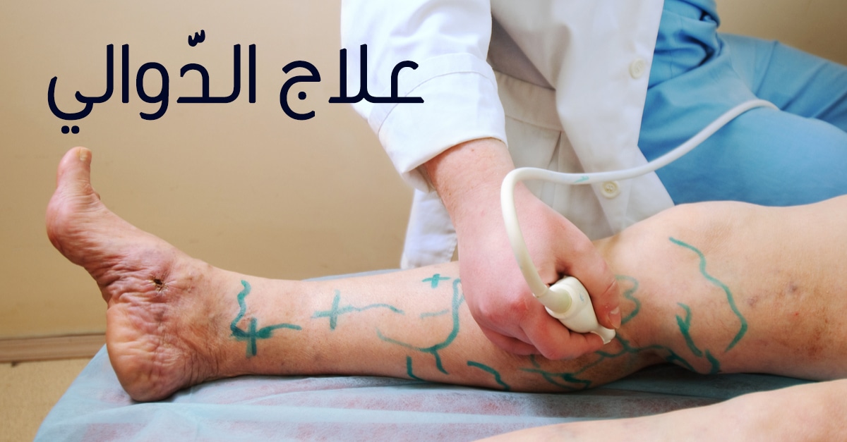 تجربتي مع علاج الدوالي بدون جراحة في مصر Tbl_articles_article_19709_60049085bdd-2fb6-47a7-a7d9-280dc1233dc5