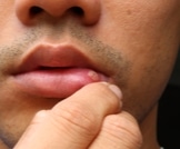 حقائق هامة عن سرطان الفم
