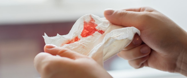 خروج الدم من الفم: الأسباب والعلاج