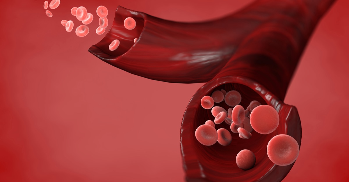 أسباب ارتفاع عدد خلايا الدم الحمراء ويب طب