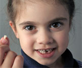 تأخر تبدل الأسنان عند الأطفال: هل يشكل خطورة؟