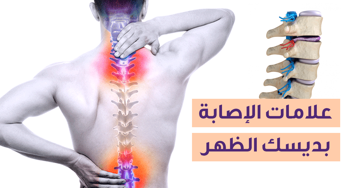علامات تشير للإصابة بديسك في أسفل الظهر ويب طب