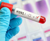 أنفلونزا الخنازير: دليلك الشامل لتعرف عليه