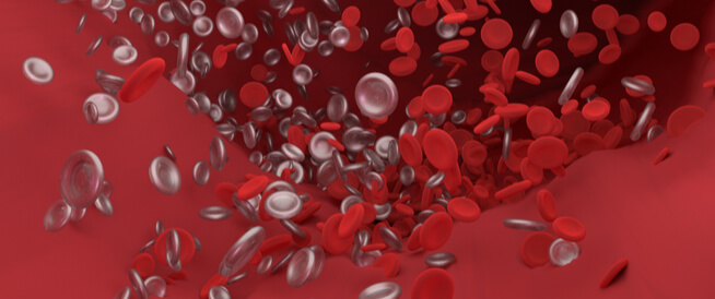 التهاب الأوعية الدموية: دليلك الشامل