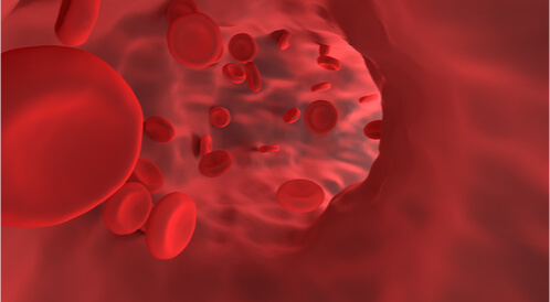 تمدد الأوعية الدموية (أم الدم): دليلك الشامل - ويب طب
