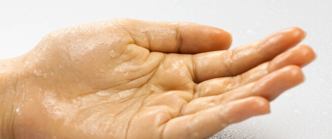 علاج تعرق اليدين: أهم الطرق الطبية والطبيعية