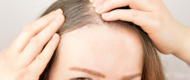 علاج الشعر الأبيض والتخلص منه طبيعيًا