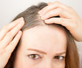 طرق علاج الشعر الأبيض طبيعيًا