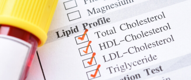 تعرف على فحص الكوليسترول الضار (LDL)