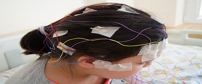 أعراض وأسباب زيادة كهرباء المخ عند الأطفال ويب طب