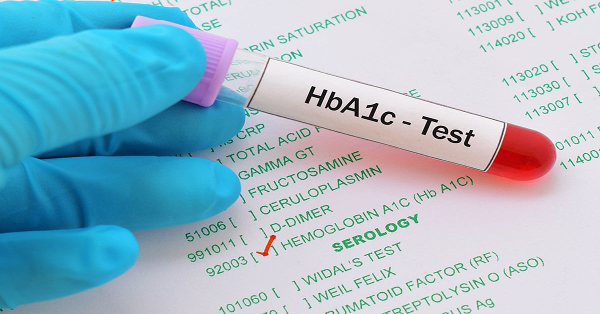 ما هو فحص الهيموغلوبين السكري Hba1c ويب طب