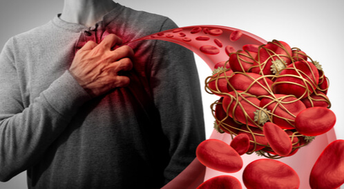 أعراض انسداد شرايين القلب - ويب طب