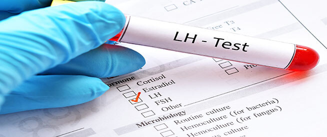 ما هو تحليل LH؟ وماذا تعني نتائجه؟