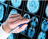 أعراض وأسباب زيادة كهرباء المخ عند الأطفال ويب طب