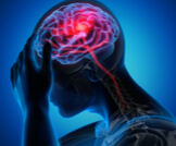 آثار الجلطة الدماغية: تعرف عليها
