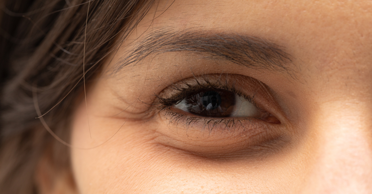 ما هي أسباب تورم العين عند الاستيقاظ - ويب طب
