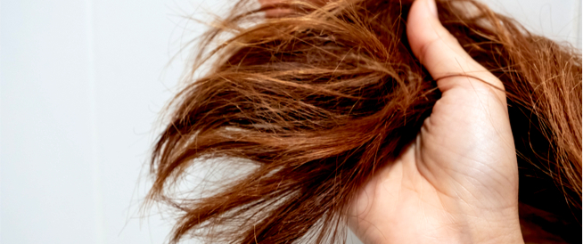 أسباب جفاف الشعر وطرق العلاج - ويب طب