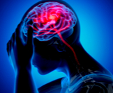 هل السكتة الدماغية تُسبب الوفاة؟