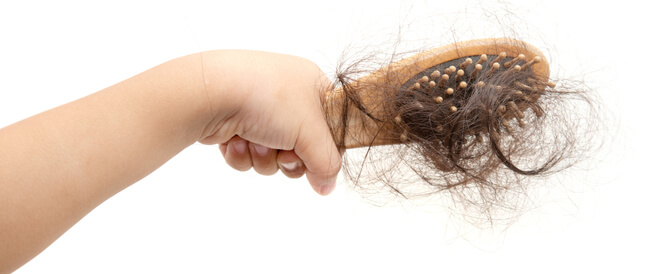 ما هي أسباب تساقط الشعر عند الأطفال؟ - ويب طب