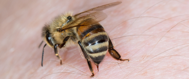 Amparate nantu à u trattamentu di a puntura di vespe - Web Medicine
