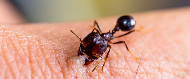 كيف يكون علاج قرصة النمل