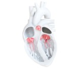 أنواع صمامات القلب