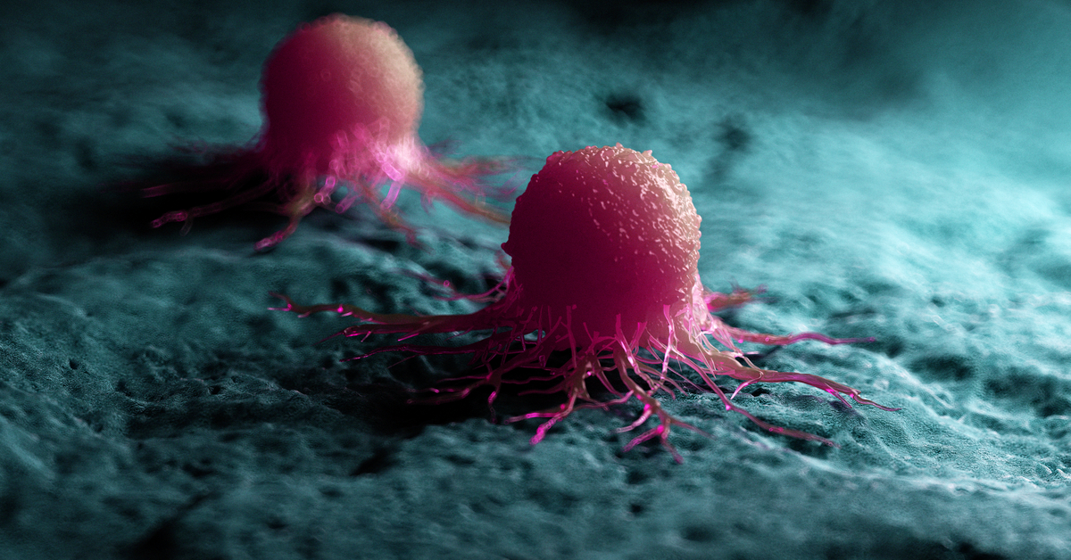 كيف يبدأ مرض السرطان - ويب طب