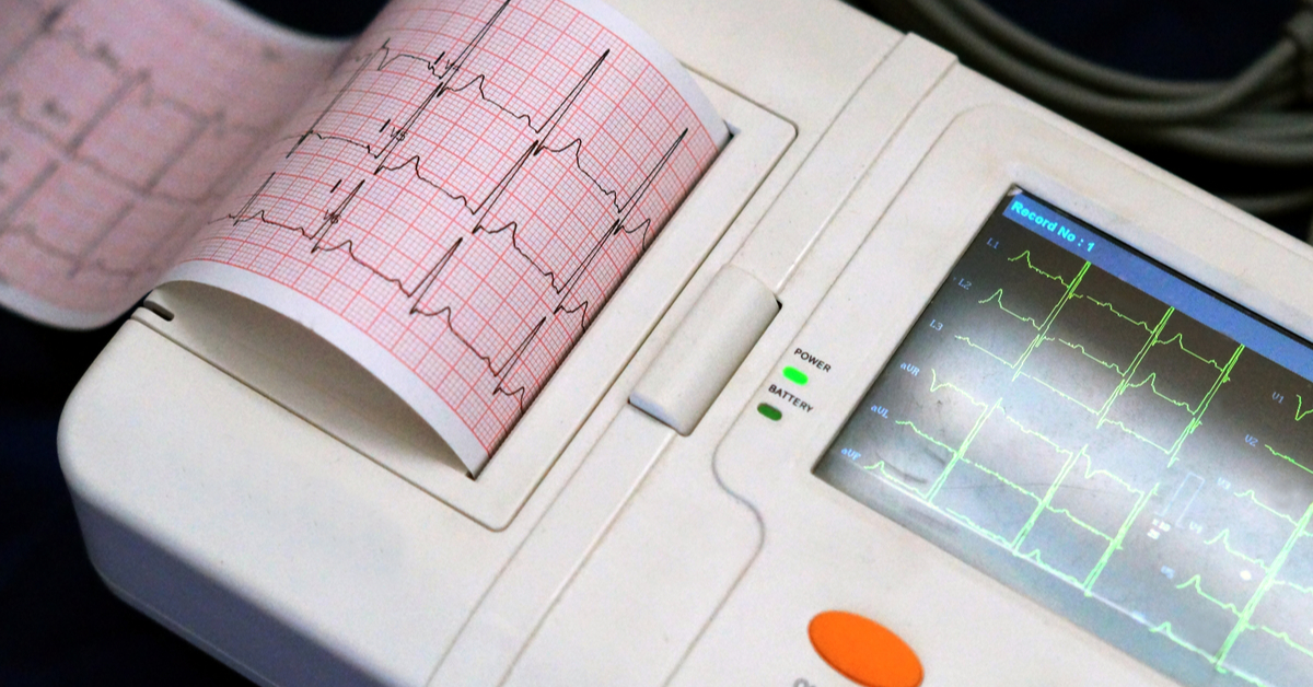 تاريخ جهاز تخطيط القلب