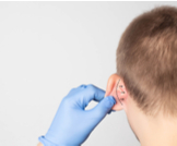 عملية تجميل الأذن: دليلك الشامل