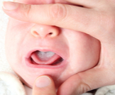 فطريات فم الرضيع: أبرز المعلومات 