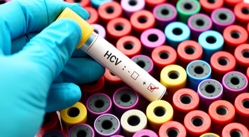 اختبار HCV: دليلك الشامل