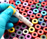 اختبار HCV: دليلك الشامل