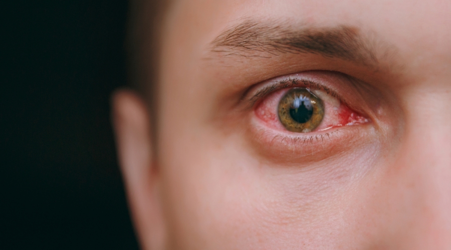 العين برنامج الحمراء ازالة تستطيع باستخدام نستطيع إزالة