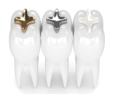 تعرف على أبرز المعلومات عن الحشوة الدائمة للأسنان