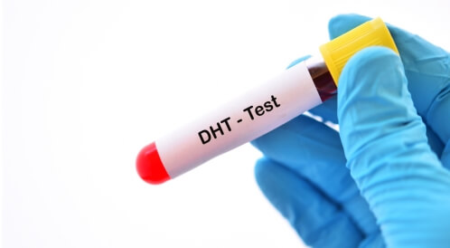 هرمون DHT: هرمون هام لتطور أجسام الذكور والإناث